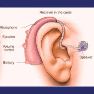 A diagram showing a RIC hearing aid in an ear. 
