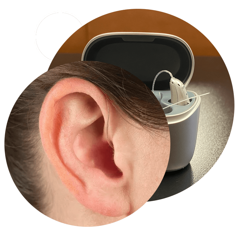 Personalized hearing aid journey