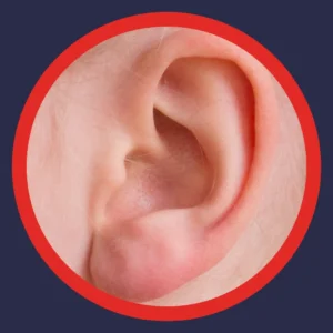 A close up of an ear.